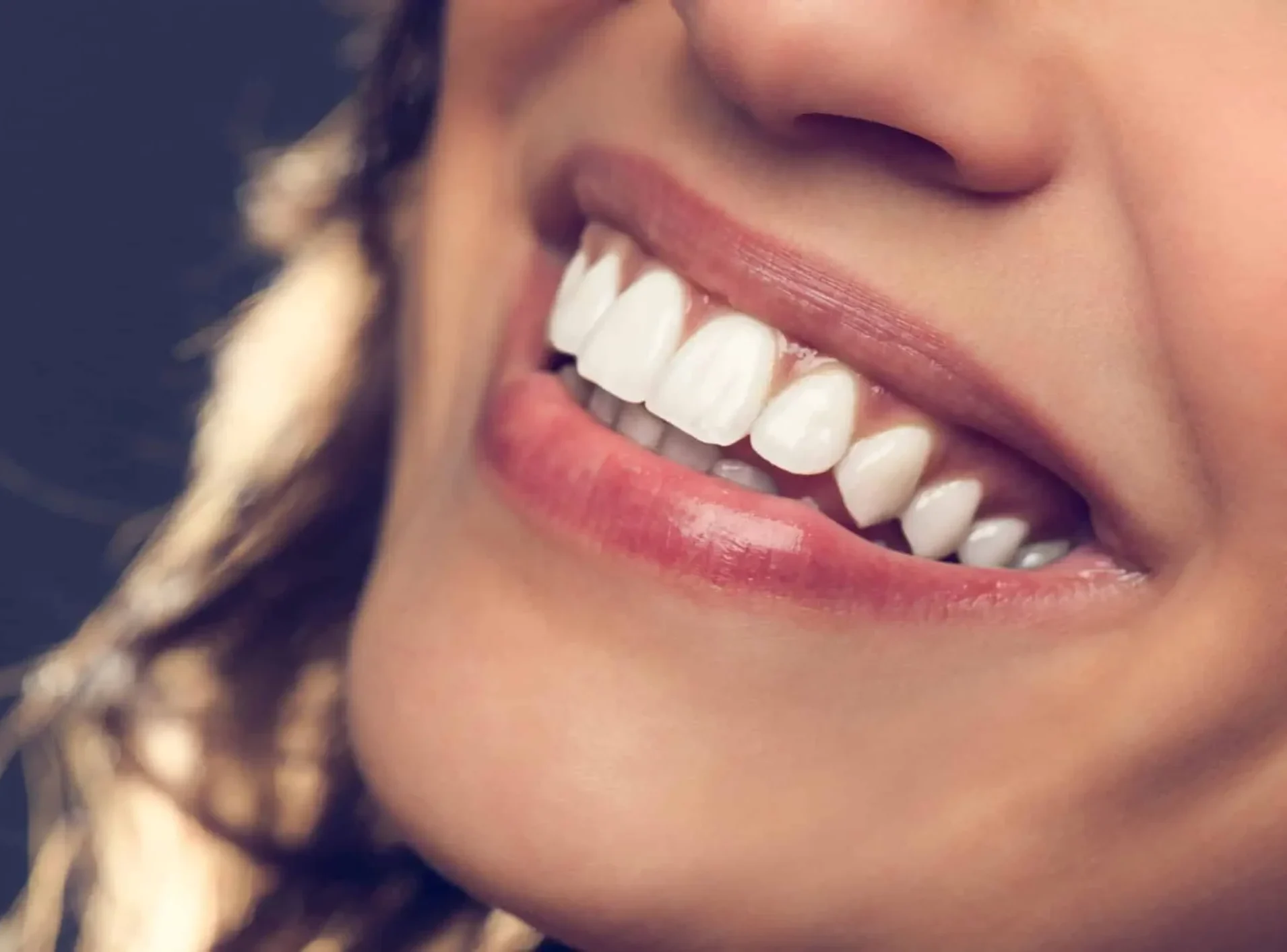 304696-como-ter-um-sorriso-perfeito-veja-7-dicas-para-arrasar (convert.io)